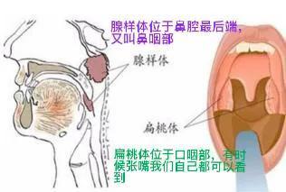 儿童睡觉打呼噜的常见原因_http://www.jzs.cc_交流_第1张